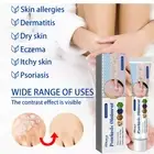 4x Psoriasis Dermatitis Eczema Natural Cream Skin Treatment Ointment