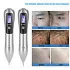 Portable LCD Dot Mole Freckle Spot Tattoo Removal Pen Beauty Skin Machine Si LVE