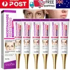 1-5PCS Niacinamide Whitening Freckle Cream Remove Dark Spots Anti-Freckle Cream