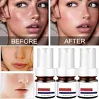 1-3 Whiting And Freckle Removing Serum Cream Dark Spot Removing Freckle Essence
