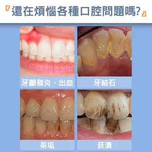 BLADE超聲波LED潔牙器 台灣公司貨 牙齒清潔 去除牙結石 便攜潔牙器 現貨 當天出貨 刀鋒