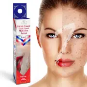 Instant Whitening Freckle Cream Face Treatment Remove Dark Spot Skin Care
