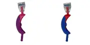 Waloo Sports NEW Scoop 'N' Score Toss Game, Indoor, Outdoor 2 Rackets 1 Ball
