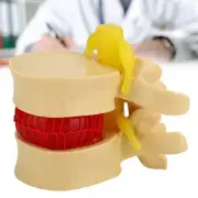 1:1.5 Lumbar Disc Herniation Demonstration Model Study Learn Human Spine EUJ