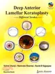 Deep Anterior Lamellar Keratoplasty Different Strokes