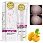 Rtopr Mango Stretch Marks and Scar Cream -Stretch Marks and Scar Removal