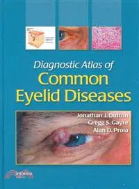 在飛比找三民網路書店優惠-Diagnostic Atlas of Common Eye