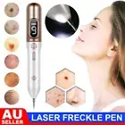 LCD Laser Plasma Pen Mole Removal Dark Spot Remover Rechargable For Skin Care