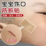 寶寶傷口防抓貼凝膠疤痕貼人工皮貼醫用兒童隱形透明止血疫苗防抓