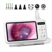 Otoscope Camera 4.5 Inch Screen HD1080P 3.9MM Lens Ear Picker 6 LEDs Ear Wax Removal Tool Ear Cleaning Stick For Dig Ear Wax Check Skin