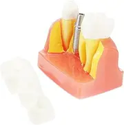 PLAFOPE 1pc Teaching Model Removable Teeth Study Tool for Patient Communication and Demonstration
