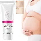 Stretch Mark And Scar Stretch Mark And Scar Removal Stretch Mark And Scar
