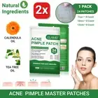 2x Remover Acne Pimple Patch Blemish Control Patches Skin Spot Removal Facial