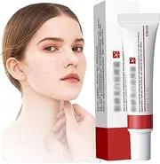 Pigmentation Removal Cream, 20g Whitening Cream for Face, Moisturizing Freckle Removal Skin Care for All Skin Type
