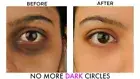 Good Bye Dark Circles, Under Eye Cream for Dark Circles, with Ginserg & Aloever