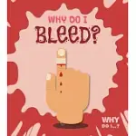 WHY DO I BLEED?