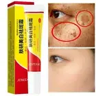 Brighten Dark Skin cream Natural Beauty product remove sunburn dark spot serum