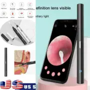 HD Ear Cleaning Kit Visual Ear Sticks wax elimination spoon Ear Wax Removal 5mm-
