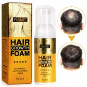 5% Minoxidil Hair Regrowth Foam Treatment for Men Hair Growing Anti Hair Loss