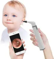Wireless Otoscope, Ear Scope with 720P HD Ear Camera and 6 LED Lights, Ear Wax