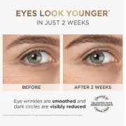L'Oreal Paris Revitalift Hyaluronic Acid Eye Serum, 20ml Reduce Fine Lines.
