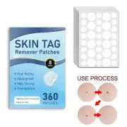 360 PCs/box Warts Remover Patch Safe Painless Skin Tags Treatment Wart.pi