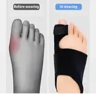 Bunion Corrector-Toe Spacers Big Toe Separator Spacer Straightener Women & Mens