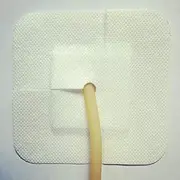 KTTR Catheter Securement Sticker (5 PCS),Peritoneal Dialysis Catheter Belt Holder,for Catheter Tube Tape Urinary Catheter Band Anti Slip Fixation,B