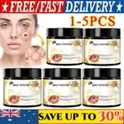 1-5X Bee Venom Skin Tag Removal Treatment Cream For Body Care Mole Corn Skin War