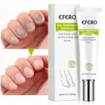 ANTI FUNGAL NAIL REPAIR GEL TREATMENT ANTI INFECTION SERUM O