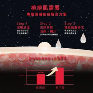 【阿皂屋】火星痘痘QQ皂(手工皂、中性皂、控油、痘痘、)