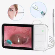 1080P Ear Wax Remover Cleaner Ear Endoscope Camera Cleaning Pick Tool IPS Screen