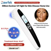 308nm Excimer Light Therapy Lamp Handheld UVB Light for Body Skin Diseases