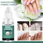 Nail Fungus Repair Lotion Nail Polish Essence Anti Infection Nail Fungus R F9K9