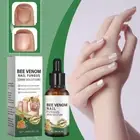 Nail Treatment Fungus Anti Fungal Toe Removal Care Liquid Solution Sale