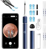 Qimic Ear Cleaner Camera with Tweezers - 1080P Ear Wax Removal with Light and Camera, IP67 Ear Camera, Ear Cleaner with Flexible Tweezers, Ear Camera Otoscope for iPhone, Android(Blue)