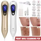 Laser LCD Skin Tag Remover Tool Electric Wart Dot Spot Mole Removal Pen Machine