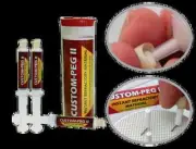 Custom Peg Putty for Pressable Ceramics and Crowns - Lot of 6 - USA - Dental Lab