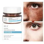 POWERFUL WHITENING CREAM FACE TO REMOVE FRECKLES DARK SPOTS