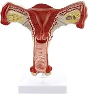 Female Reproductive System Anatomical Model - Uterus Model - Internal Reproductive System Medical Teaching Model - for Gynecology Training Aid, Science Kits, Laboratory Material