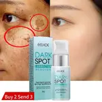 NICOTINAMIDE WHITENING FRECKLE CREAM DARK SPOT REMOVER SKIN