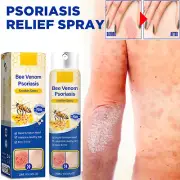 5PCS Bee Venom Psoriasis Treatment Spray Psoriasis Care Spray Pro Anti-itching