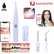 Electric Visual Teeth Cleaner Dental Endoscope Plaque Scaler Calculus Remover AU