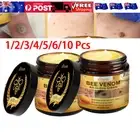 Bee Venom Skin Treatments Cream Natural Herbal Effective Skin-Tag Removal Cream