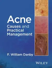 在飛比找博客來優惠-Acne: Causes and Practical Man