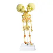 Human Infant Skeleton Model, Twin-Skull, Human Fetus Skeleton W/Double-Skull ...