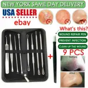 9 Pcs Blackhead Pimple Comedone Spot Acne Extractor Remover Kit Acne Tools