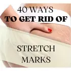 Stretch Marks Be Gone: 40 Proven Ways to Prevent and Treat Stretch Marks - eBook
