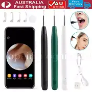 Wireless Ear Wax Remover Camera HD Ear Endoscope Spoon Pick Cleaning Tools Kit.