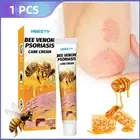 Bee Venom Psoriasis Care Psoriasis Cream Ointment Skin Treatment Scalp Hand Foot